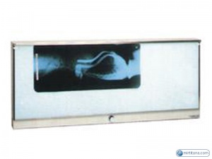 Экран для просмотра рентгеновских снимков
